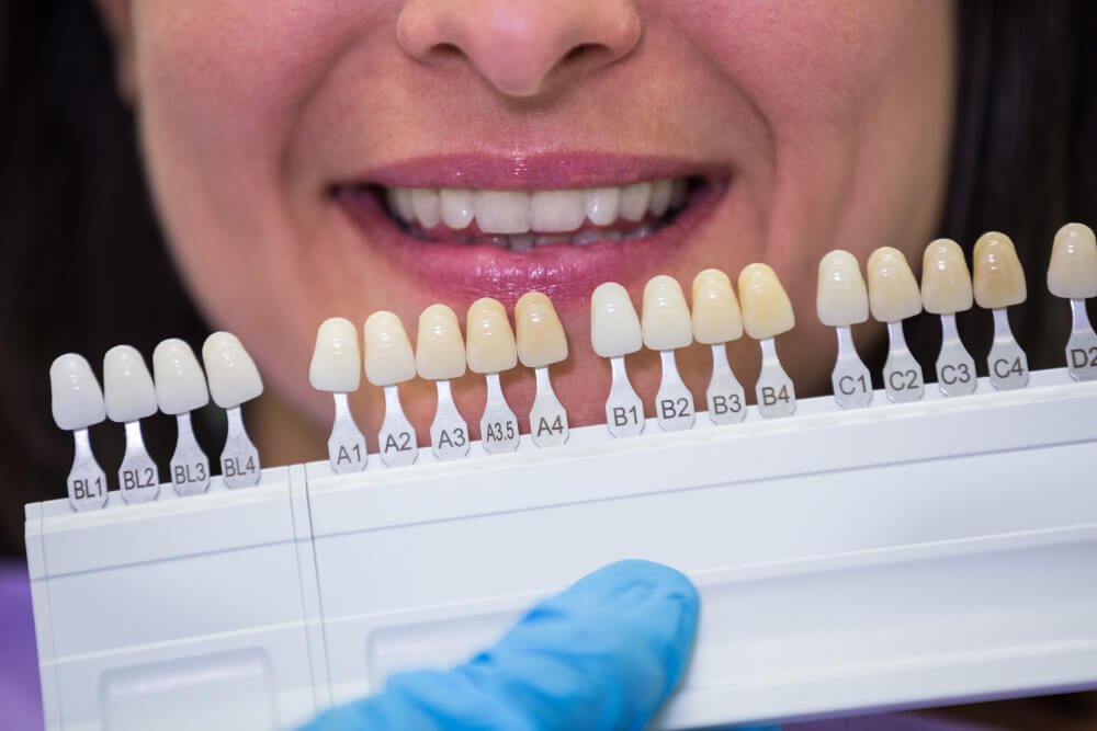 Best Aesthetic Dentist Near Me